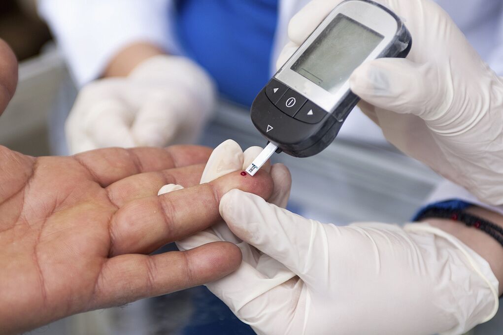 Blood test to determine fasting plasma glucose concentration to diagnose diabetes.